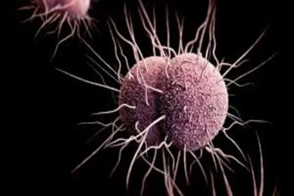 Gonorrhea Home Remedies